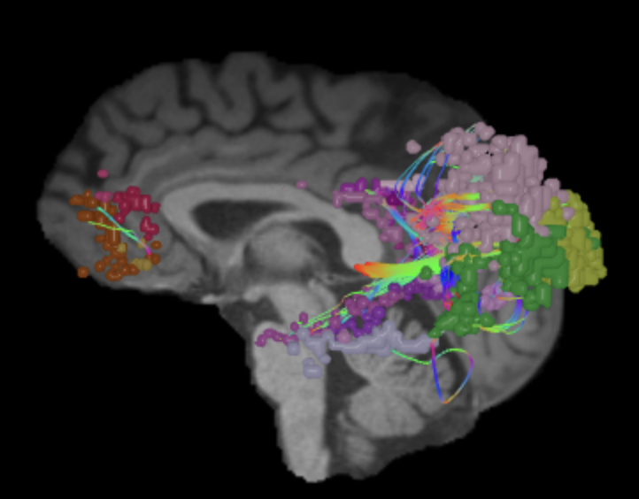 Default Mode Network Connectome Guide 1659